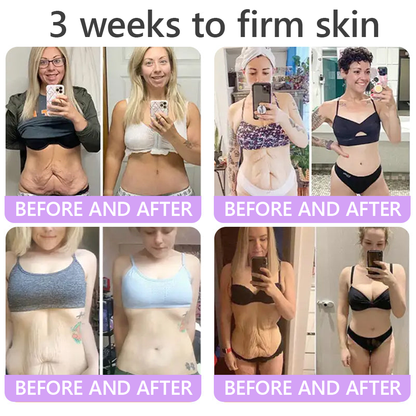 🎁HISKIN® Only 5 boxes left! We're offering you an additional 30% discount! Get yourself in shape and healthy. Miss out now, and you won't have another chance until next year.