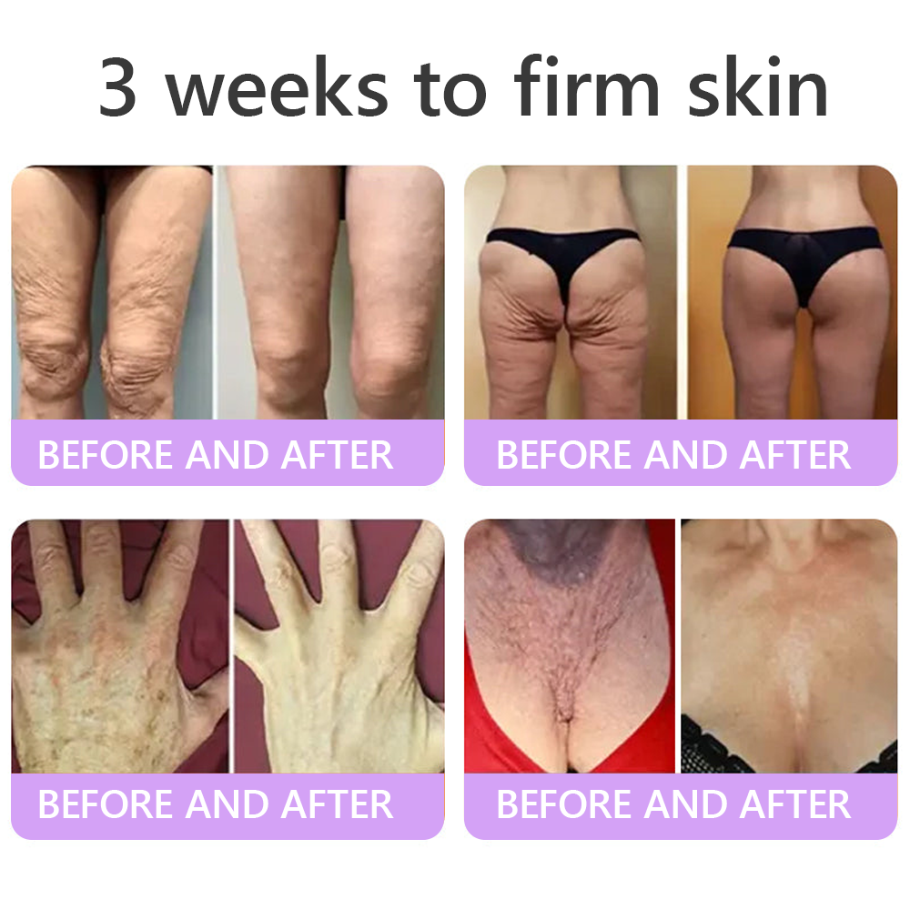 🎁HISKIN® Only 5 boxes left! We're offering you an additional 30% discount! Get yourself in shape and healthy. Miss out now, and you won't have another chance until next year.
