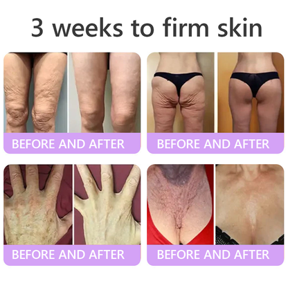 🎁HISKIN® Only 5 boxes left! We're offering you an additional 30% discount! Get yourself in shape and healthy. Miss out now, and you won't have another chance until next year.