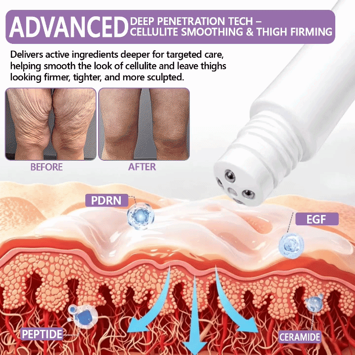 FDA Official: 𝐇𝐈𝐒𝐊𝐈𝐍® 𝐏𝐃𝐑𝐍 𝐌𝐮𝐥𝐭𝐢-𝐏𝐞𝐩𝐭𝐢𝐝𝐞 𝐌𝐚𝐬𝐬𝐚𝐠𝐢𝐧𝐠 𝐁𝐨𝐝𝐲 𝐑𝐨𝐥𝐥𝐞𝐫 𝐂𝐫𝐞𝐚𝐦- Anti-aging, Hydrating, Skin Firming & Lifting, Skin Repair, Even Tone, Acne and Dark Spot Treatment, Wart and Mole Removal, and Psoriasis Relief.